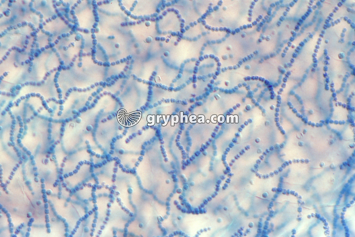 Cyanobactéries (Nostocs) x100 - gryphea.com